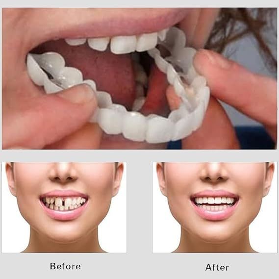 Snap On Smile Veneers Teeth For Men And Women Moldable False Artificial Braces Teeth Kits